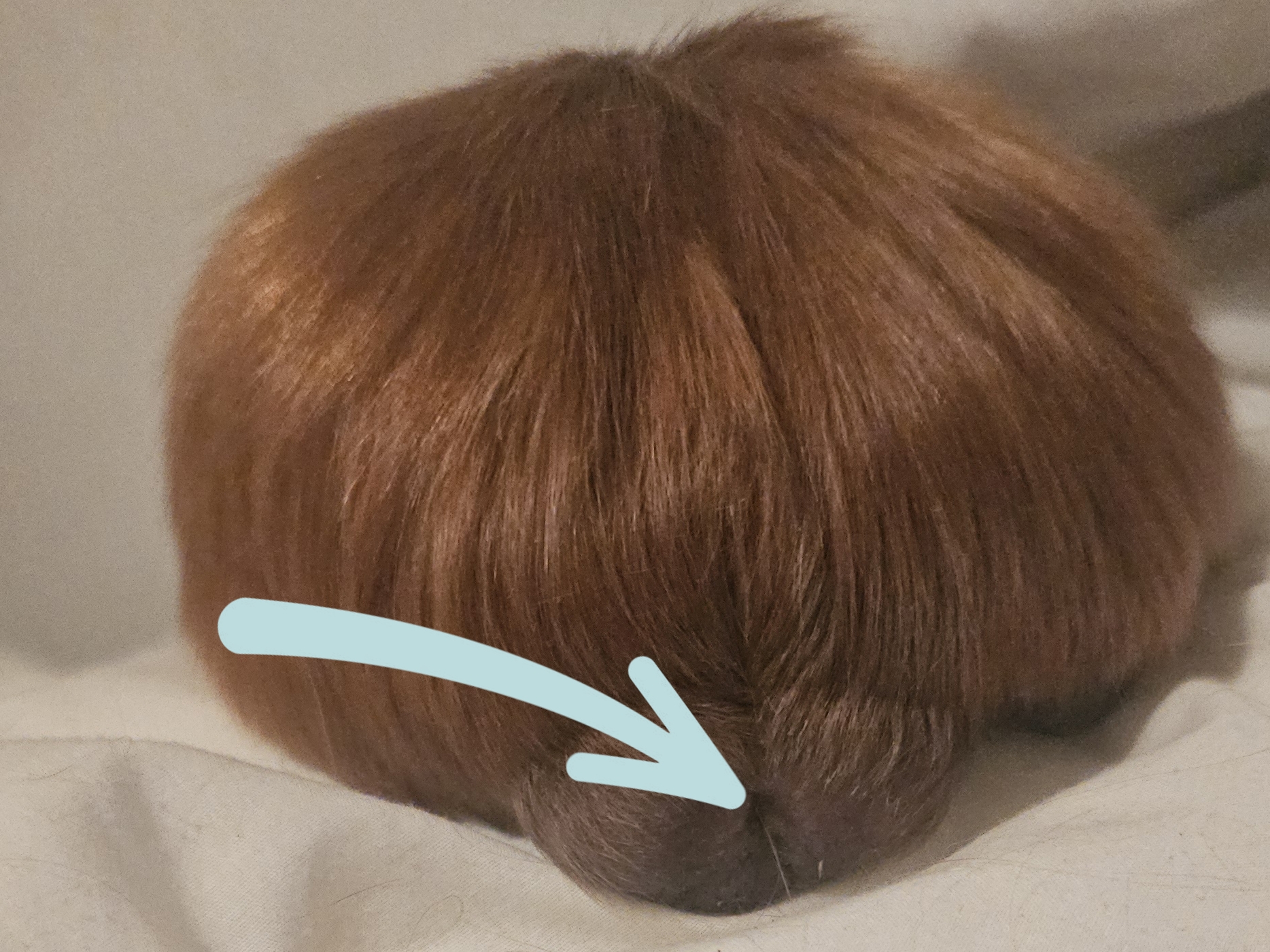 Расположен каловый карман вот тут